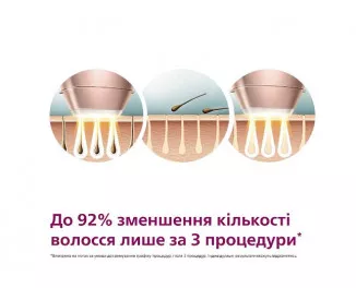 Фотоепілятор PHILIPS Lumea IPL 9900 Series BRI973/00