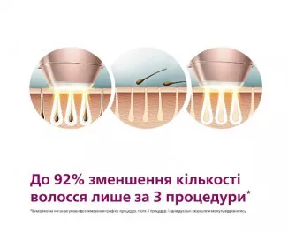 Фотоепілятор PHILIPS Lumea IPL 9900 Series BRI977/00