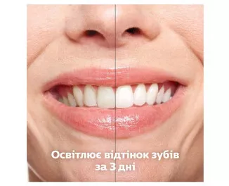 Зубная электрощетка PHILIPS Sonicare DiamondClean Smart 9400 HX9917/88
